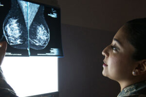 Chez la femme, 30% des cas de cancer surviennent au sein – Jornal da USP