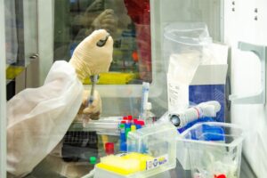 Les infections par la variante brésilienne du covid-19 ont une charge virale 10 fois plus élevée, selon une étude de Fiocruz