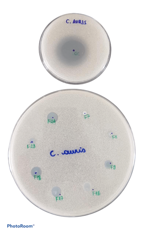 Plaques de culture montrant des halos d'inhibition par l'action de l'huile essentielle de Lippia sidoides (en haut) et des formulations de nanoparticules (en bas) - Photo : Archives personnelles