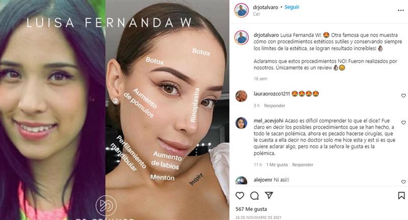 Commentaire du docteur Otalvaro sur Luisa Fernanda W. Photo : Instagram @drjotalvaro