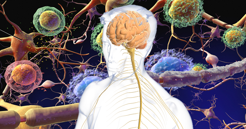 Un diagnostic précoce est essentiel dans le traitement de la sclérose en plaques – Jornal da USP