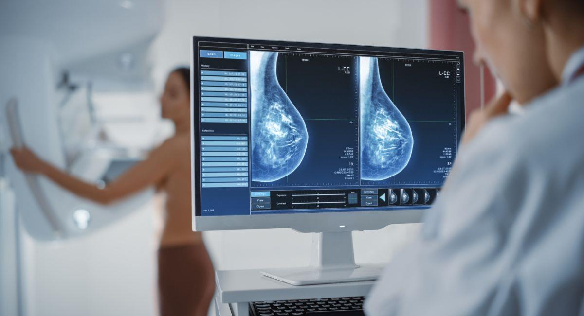 Hallan genes que aumentan las probabilidades de padecer cáncer. Foto: Shutterstock
