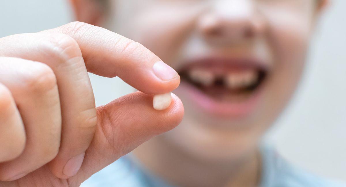 Esta es la razón por la que sueñas que se te caen los dientes. Foto: Shutterstock