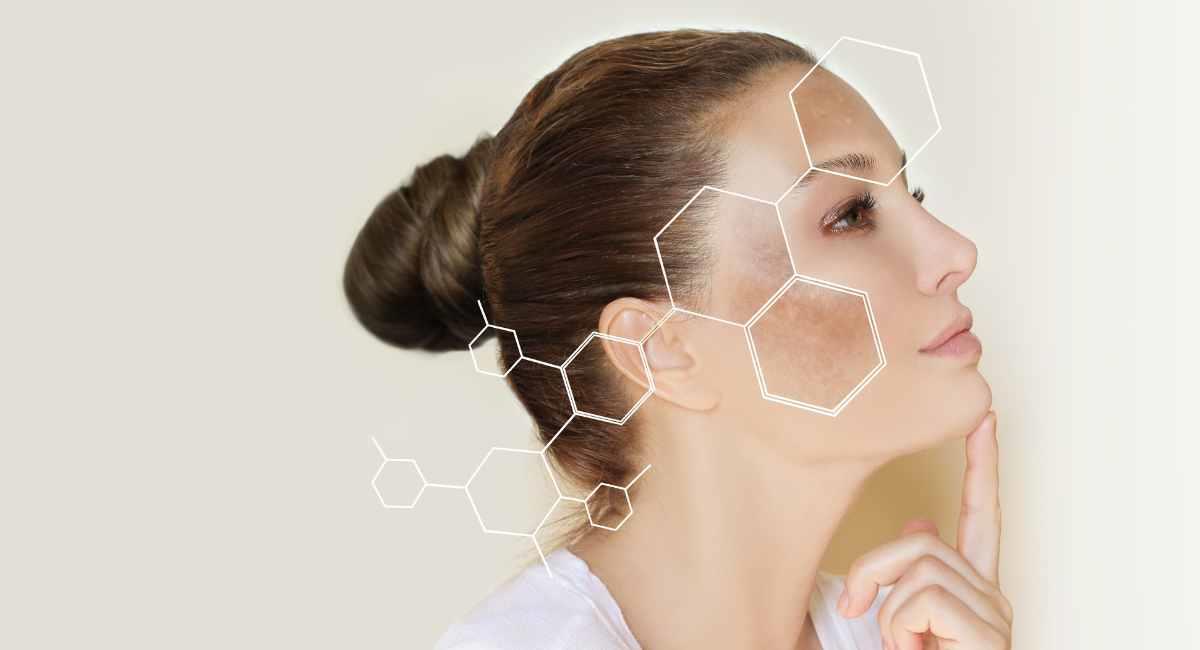 La mascarilla que te ‘hará el cruce’ para tener un rostro sin manchas. Foto: Shutterstock