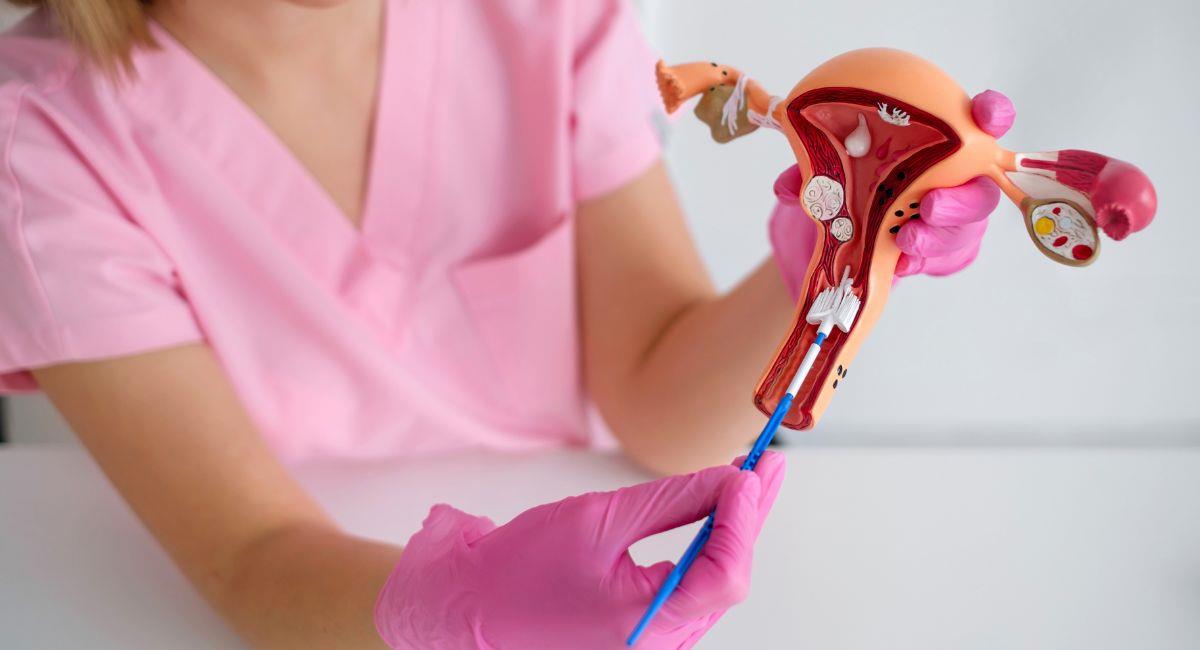 Nueva IA detecta cáncer endometrial con 99% de precisión. Foto: Shutterstock