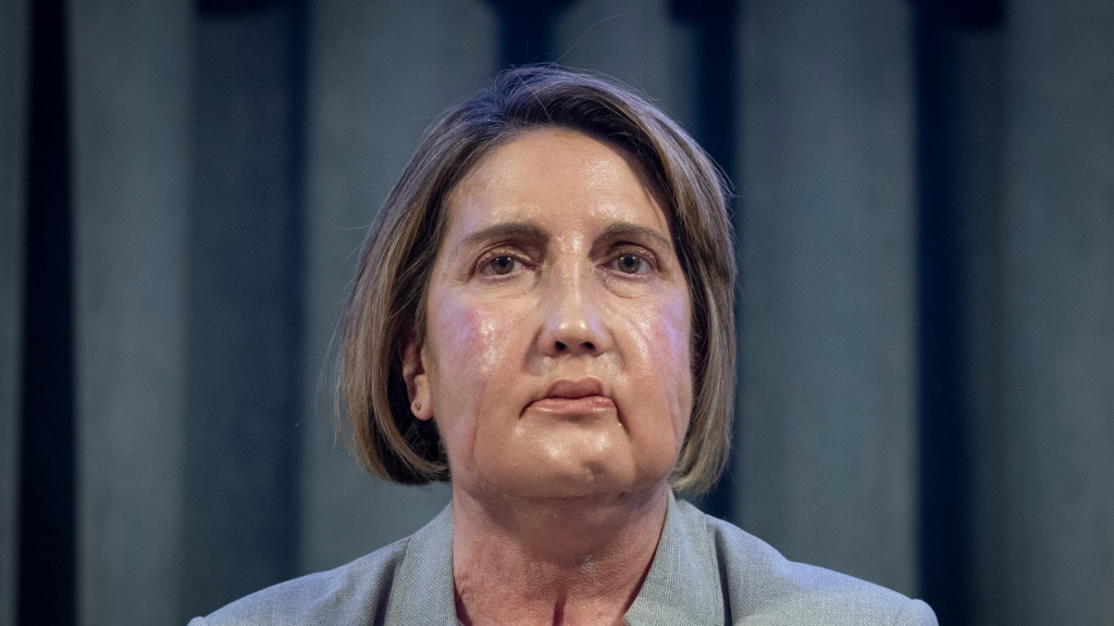 Ils réalisent la première greffe du visage avec un donneur euthanasié