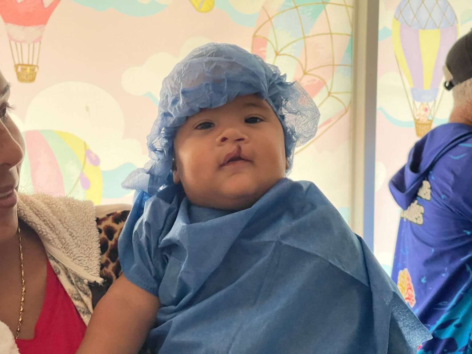 Début des séances de chirurgie maxillo-faciale pour enfants au HCM